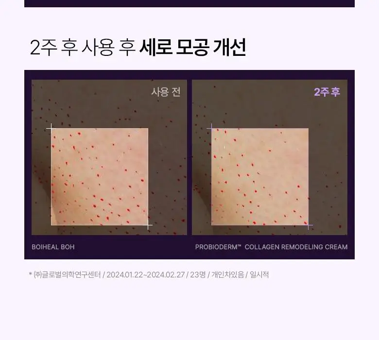 [모공고민|화잘먹] 바이오힐보 프로바이오덤 콜라겐 리모델링 크림 [단품/증정기획] 상세페이지 15